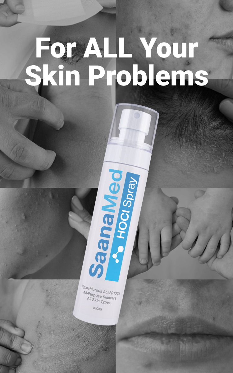 SaanaMed HOCI Spray with text 'For ALL Your Skin Problems' on a collage of skin care images.