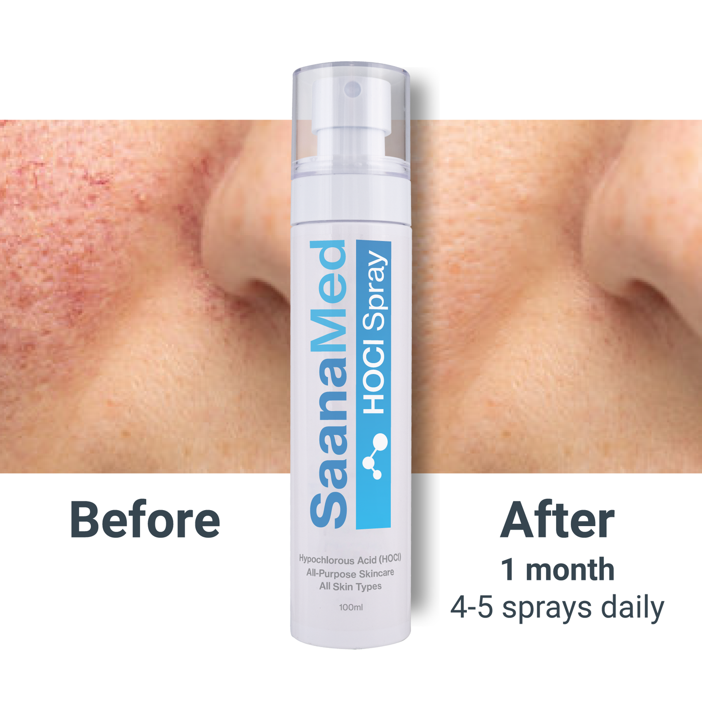 SaanaMed Spray
