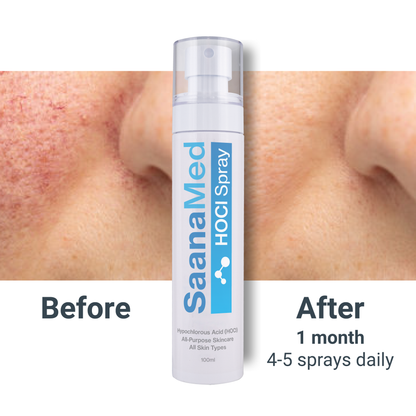 SaanaMed Spray